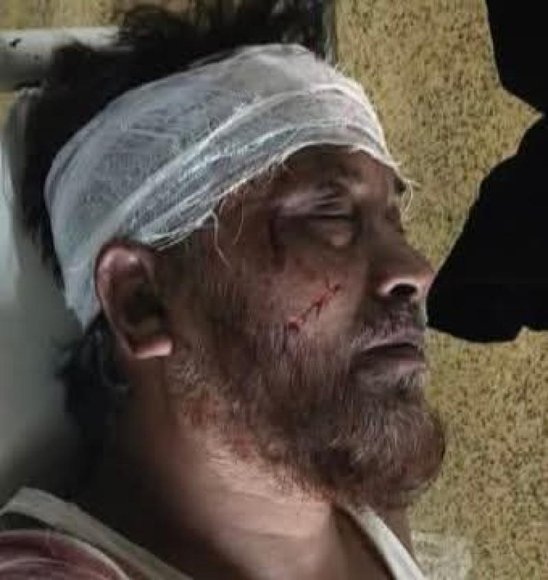 নাইক্ষ্যংছড়ির জামায়াত নেতা রফিক আহমদ সড়ক দুর্ঘটনায় আহত